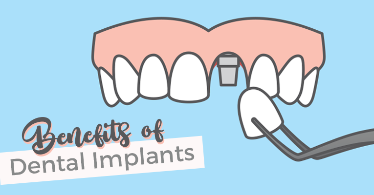 Top-rated  Orthodontics Dental Implants   
 thumbnail